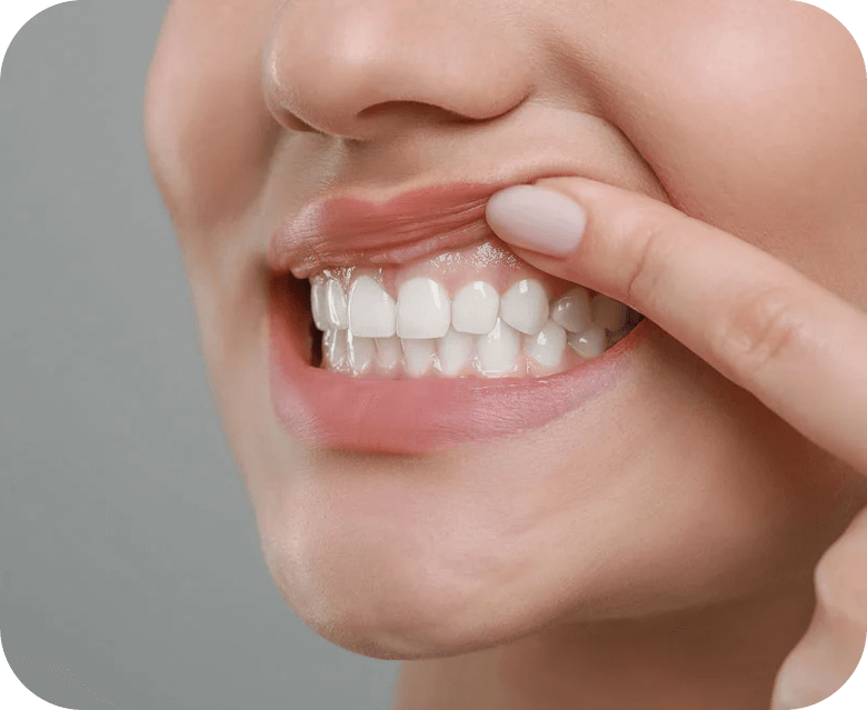 periodontitis en Cuernavaca